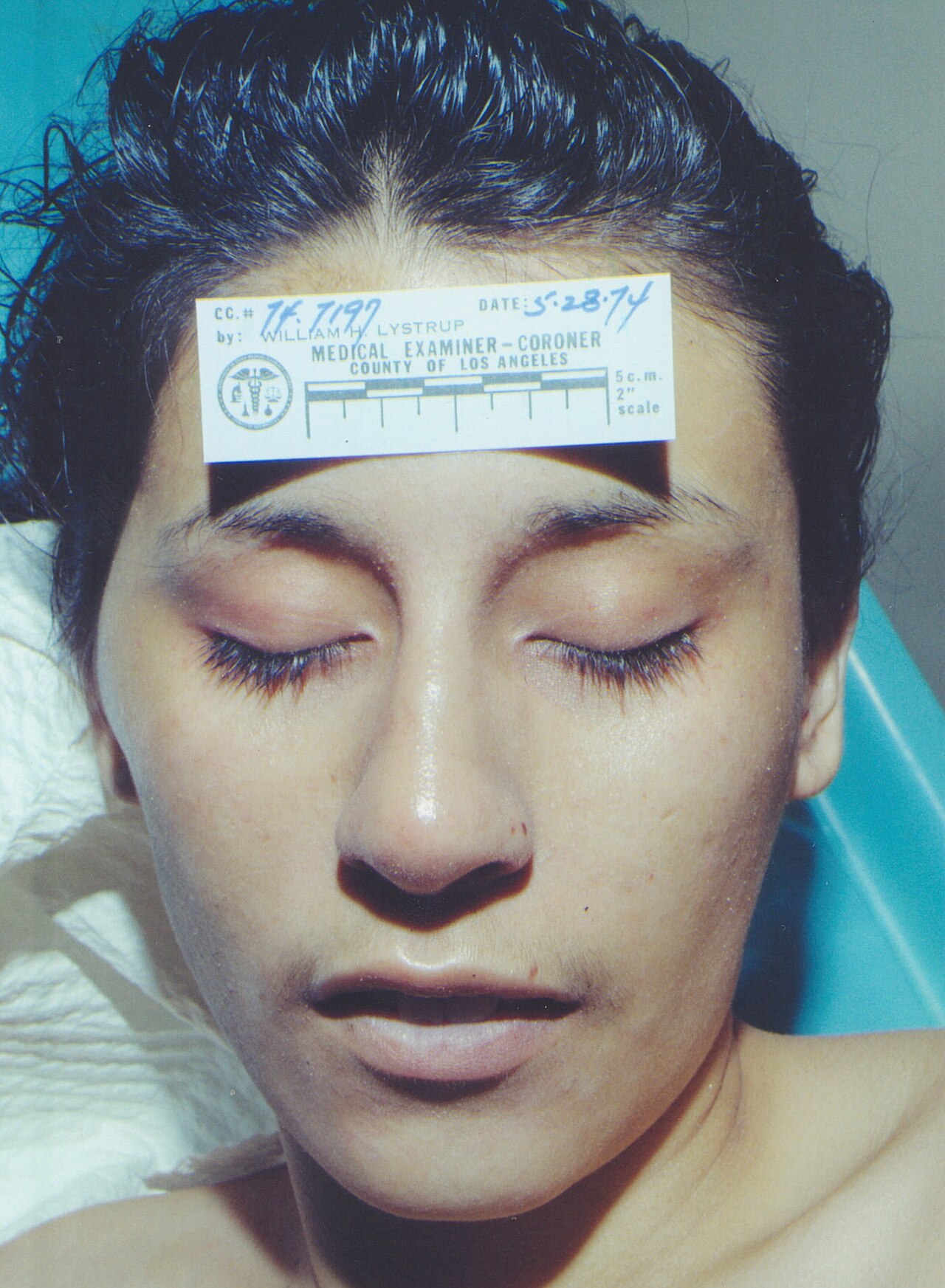Jane Doe — Long Beach Jane Doe postmortem2